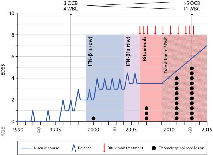 https://cdn.ncbi.nlm.nih.gov/pmc/blobs/e175/5221476/f173e6472010/ACN3-4-46-g001.jpg