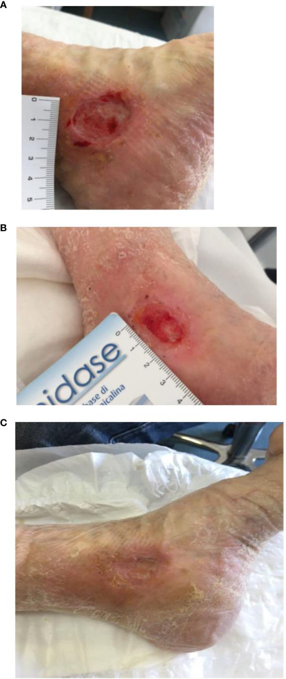 https://cdn.ncbi.nlm.nih.gov/pmc/blobs/e17d/10760803/a89aca5962c5/fendo-14-1286907-g001.jpg