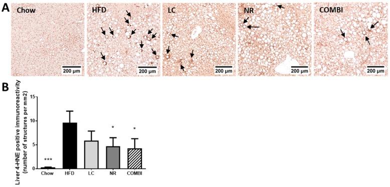 https://cdn.ncbi.nlm.nih.gov/pmc/blobs/e184/6770226/d8ea44105c82/ijms-20-04359-g004.jpg