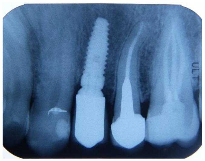 https://cdn.ncbi.nlm.nih.gov/pmc/blobs/e193/11505686/4858a94c180f/dentistry-12-00320-g008.jpg