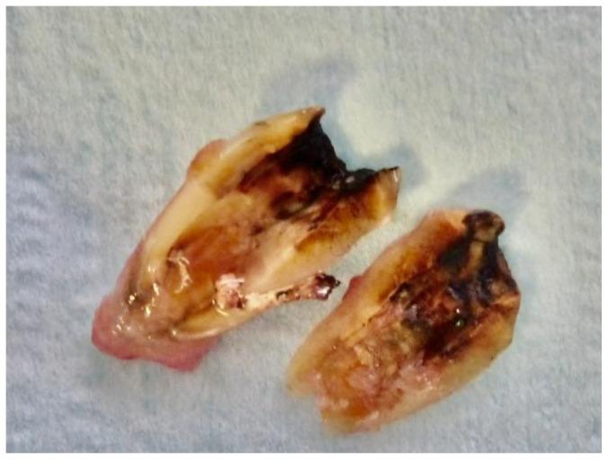 https://cdn.ncbi.nlm.nih.gov/pmc/blobs/e193/11505686/5e8763a8200f/dentistry-12-00320-g002.jpg
