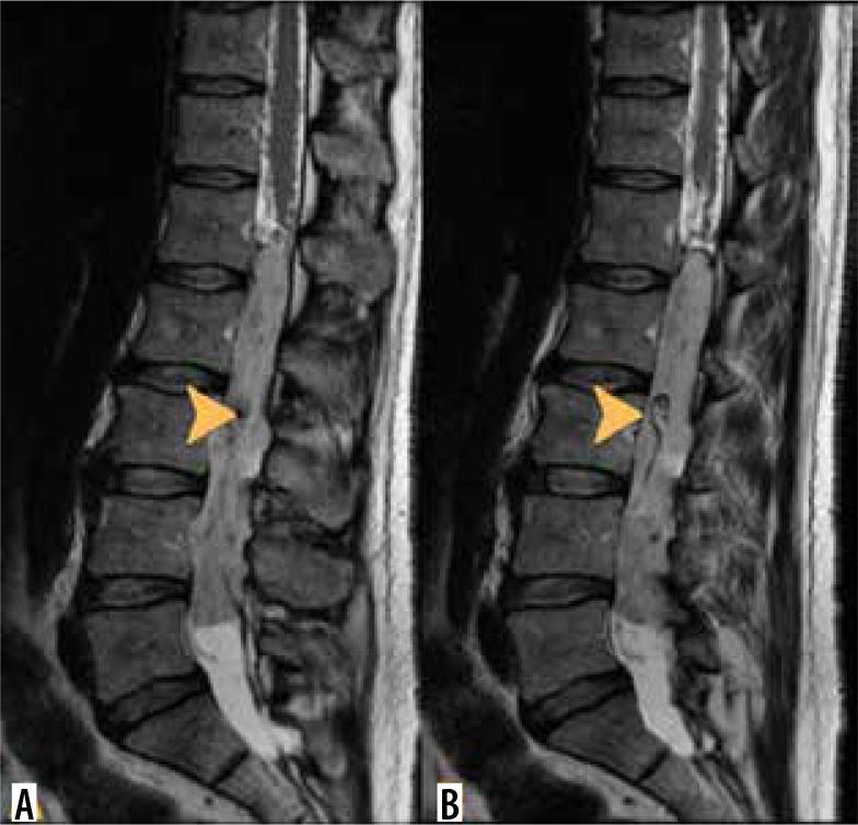 https://cdn.ncbi.nlm.nih.gov/pmc/blobs/e193/11705043/0468a7193cbe/PJR-89-192424-g012.jpg