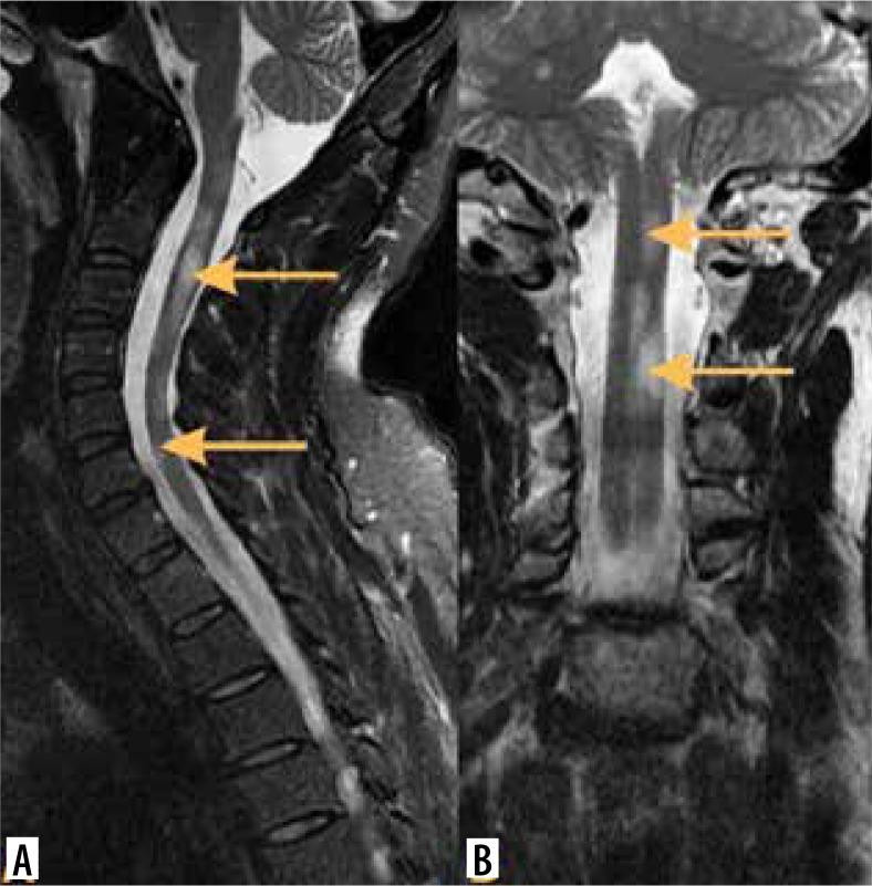 https://cdn.ncbi.nlm.nih.gov/pmc/blobs/e193/11705043/a7e580654270/PJR-89-192424-g014.jpg