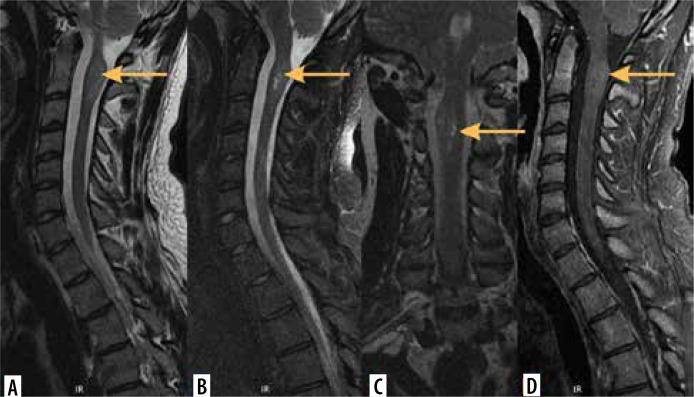 https://cdn.ncbi.nlm.nih.gov/pmc/blobs/e193/11705043/c92550624a7b/PJR-89-192424-g009.jpg