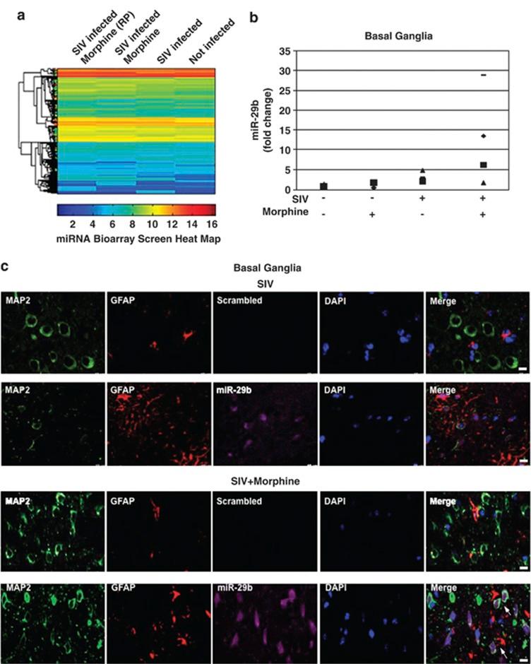 https://cdn.ncbi.nlm.nih.gov/pmc/blobs/e19a/3434655/5fb9f4f15d37/cddis2012114f1.jpg