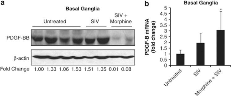 https://cdn.ncbi.nlm.nih.gov/pmc/blobs/e19a/3434655/887c7ccc2892/cddis2012114f2.jpg