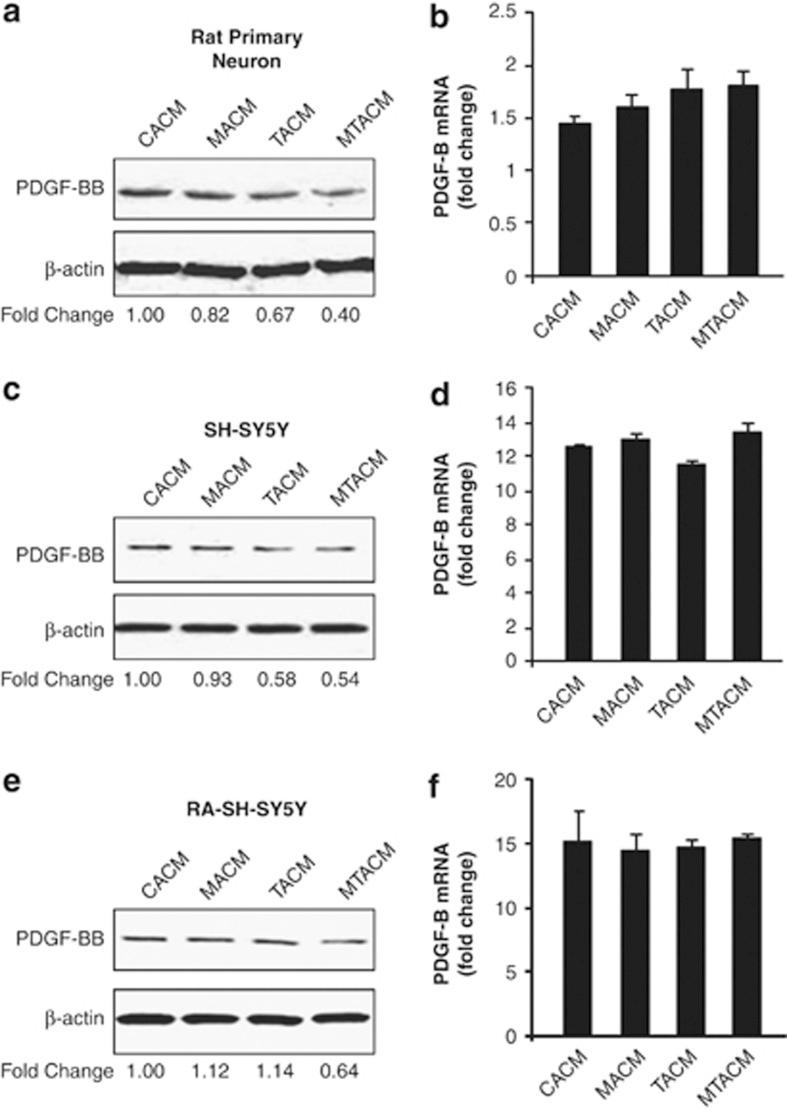 https://cdn.ncbi.nlm.nih.gov/pmc/blobs/e19a/3434655/bdd31f00d78a/cddis2012114f3.jpg