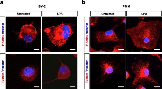 https://cdn.ncbi.nlm.nih.gov/pmc/blobs/e19c/5002165/40da514efb12/12974_2016_701_Fig2_HTML.jpg