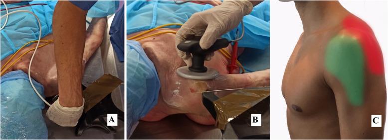 https://cdn.ncbi.nlm.nih.gov/pmc/blobs/e19e/7860630/e41d36545ce7/12891_2020_3918_Fig1_HTML.jpg