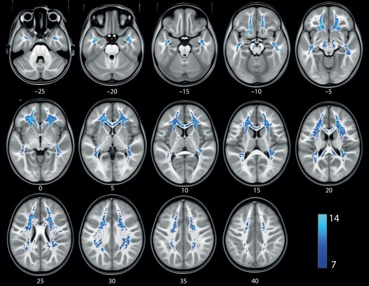 https://cdn.ncbi.nlm.nih.gov/pmc/blobs/e1a1/6319170/505a4fc519f9/bhy277f02.jpg