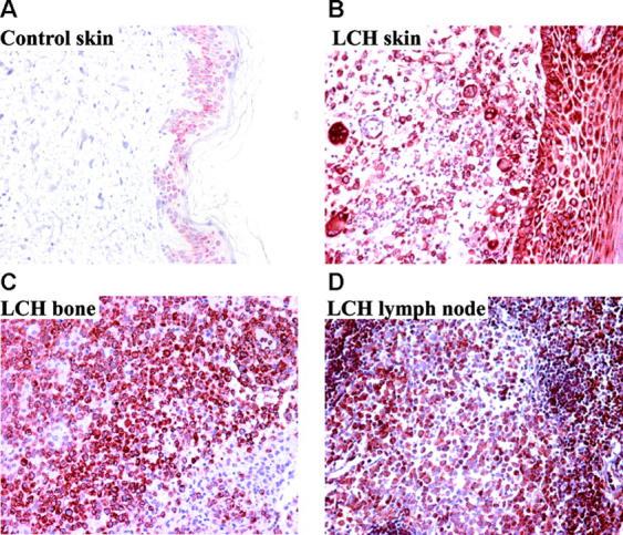 https://cdn.ncbi.nlm.nih.gov/pmc/blobs/e1a6/2193776/2f8711203b4b/20030137f2.jpg