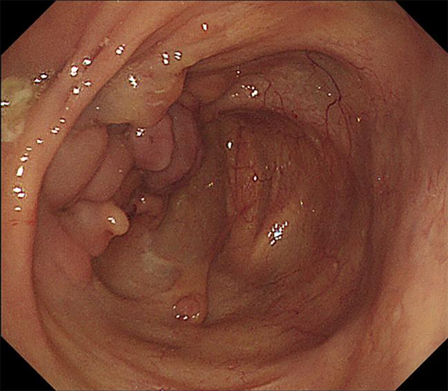 https://cdn.ncbi.nlm.nih.gov/pmc/blobs/e1ae/8891770/b02709affc2c/WJCC-10-2030-g001.jpg