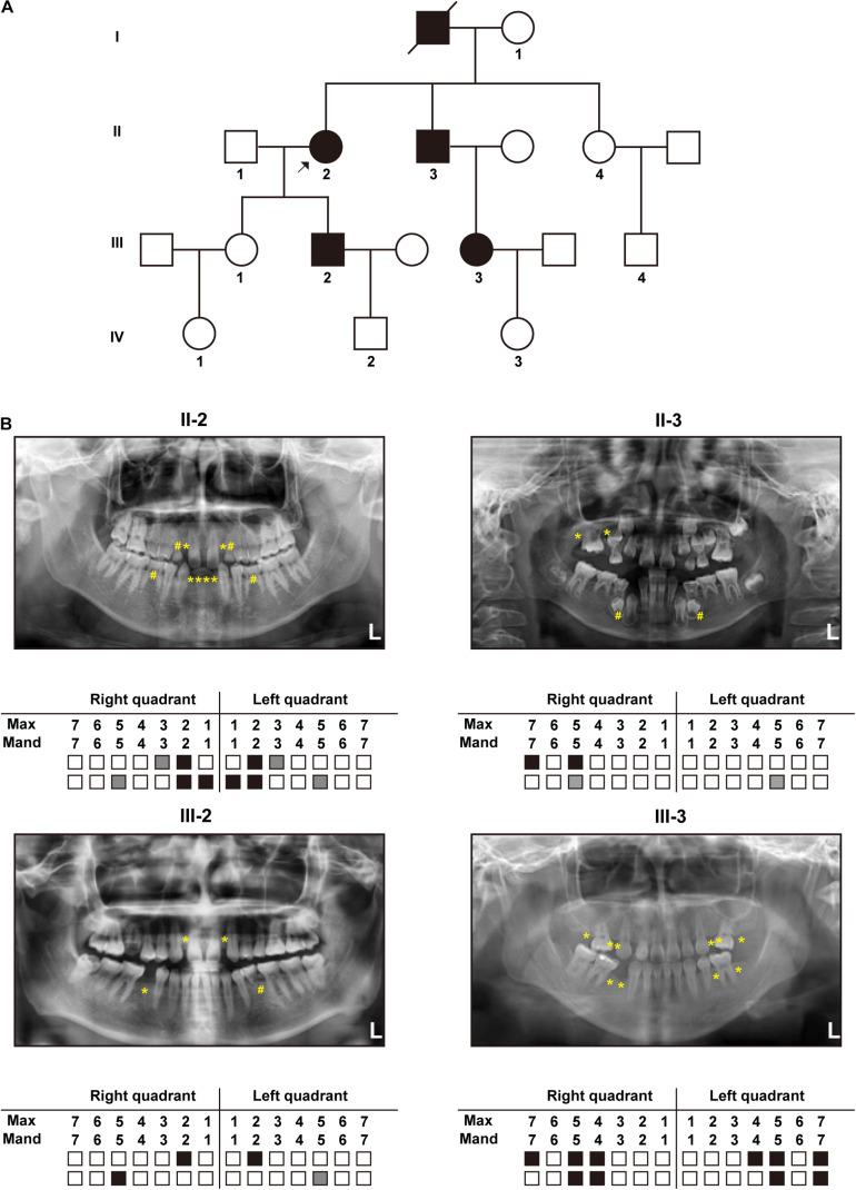 https://cdn.ncbi.nlm.nih.gov/pmc/blobs/e1b2/8292820/be47508fafb4/fgene-12-688241-g001.jpg