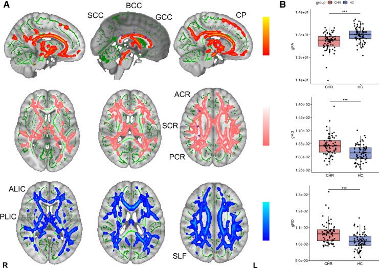 https://cdn.ncbi.nlm.nih.gov/pmc/blobs/e1b2/9014058/2d8692eb8482/gpsych-2021-100703f03.jpg