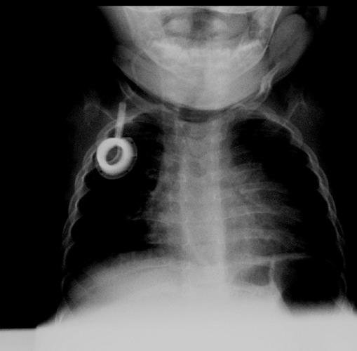 https://cdn.ncbi.nlm.nih.gov/pmc/blobs/e1b6/4227319/fe94b8c30678/pr-2012-3-e32-g007.jpg