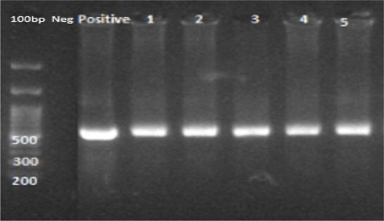https://cdn.ncbi.nlm.nih.gov/pmc/blobs/e1b7/11978203/9a408ebe1b79/IJPA-20-44-g001.jpg