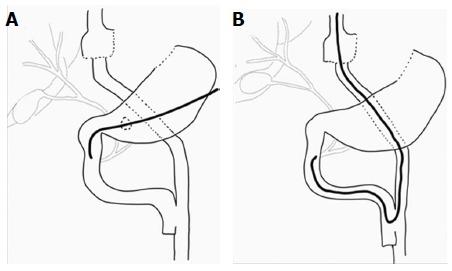 https://cdn.ncbi.nlm.nih.gov/pmc/blobs/e1c1/5355758/ead8b0db6048/WJGE-9-105-g008.jpg