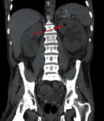 https://cdn.ncbi.nlm.nih.gov/pmc/blobs/e1d1/7539112/c5b62d28b977/CRIU2020-8828289.003.jpg