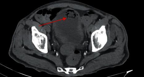 https://cdn.ncbi.nlm.nih.gov/pmc/blobs/e1d1/7539112/ca69184b0569/CRIU2020-8828289.002.jpg