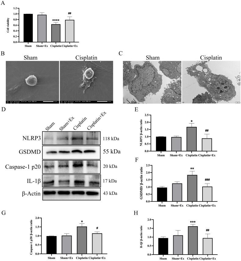 https://cdn.ncbi.nlm.nih.gov/pmc/blobs/e1d5/10259332/28463fca5d2d/IRNF_A_2221138_F0007_C.jpg