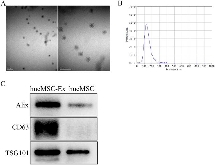 https://cdn.ncbi.nlm.nih.gov/pmc/blobs/e1d5/10259332/2c7b10954fd7/IRNF_A_2221138_F0001_C.jpg