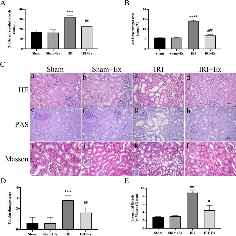 https://cdn.ncbi.nlm.nih.gov/pmc/blobs/e1d5/10259332/2e8e98375c90/IRNF_A_2221138_F0002_C.jpg