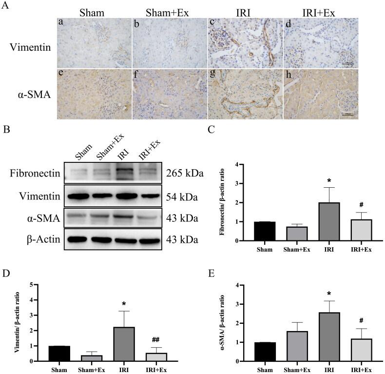 https://cdn.ncbi.nlm.nih.gov/pmc/blobs/e1d5/10259332/2f8cd3e41f4c/IRNF_A_2221138_F0003_C.jpg