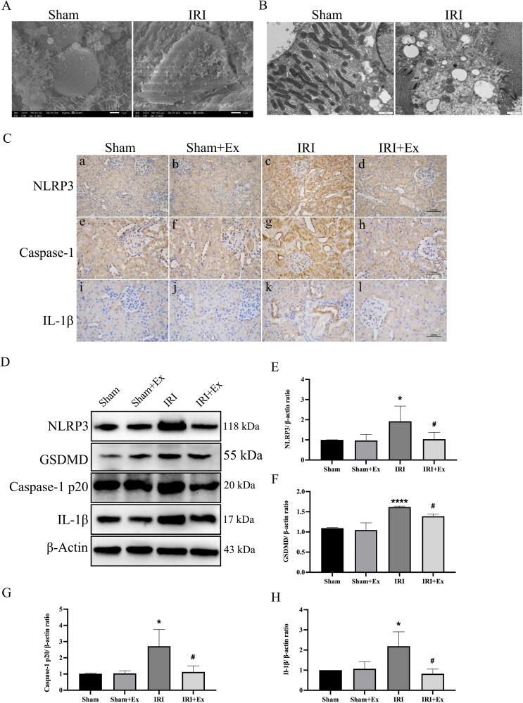 https://cdn.ncbi.nlm.nih.gov/pmc/blobs/e1d5/10259332/77052522215c/IRNF_A_2221138_F0004_C.jpg