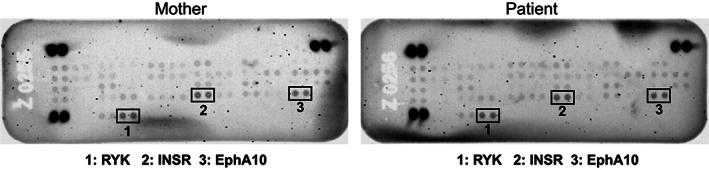 https://cdn.ncbi.nlm.nih.gov/pmc/blobs/e1d6/9981410/0dc5cde2df51/JMD2-64-138-g005.jpg