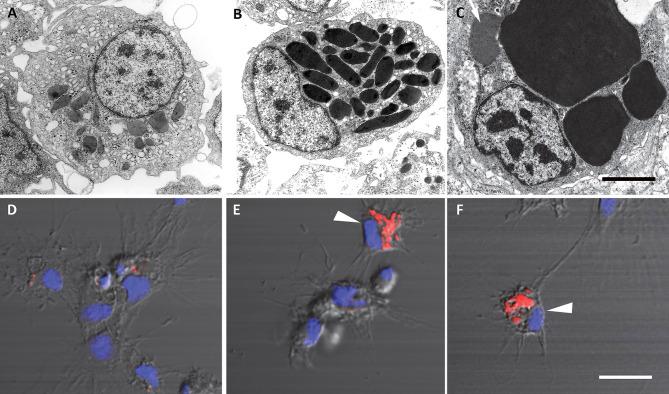 https://cdn.ncbi.nlm.nih.gov/pmc/blobs/e1d8/9178244/23b4520b8f53/fimmu-13-879122-g002.jpg