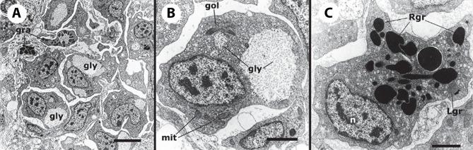 https://cdn.ncbi.nlm.nih.gov/pmc/blobs/e1d8/9178244/e6c21ec5cb52/fimmu-13-879122-g006.jpg