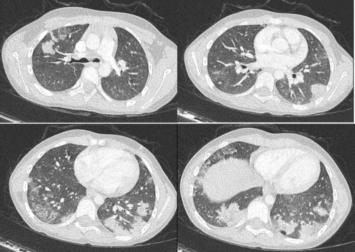https://cdn.ncbi.nlm.nih.gov/pmc/blobs/e1da/12003937/36c51e048467/JPC-61-639-g001.jpg