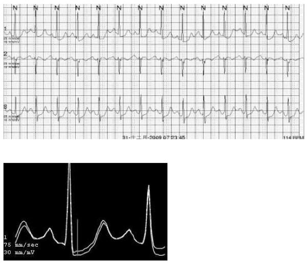 https://cdn.ncbi.nlm.nih.gov/pmc/blobs/e1dd/3458961/acc37215706c/1475-2840-11-104-2.jpg
