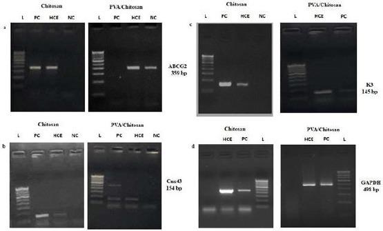 https://cdn.ncbi.nlm.nih.gov/pmc/blobs/e1e0/6182522/218faf93ea09/OAMJMS-6-1561-g005.jpg