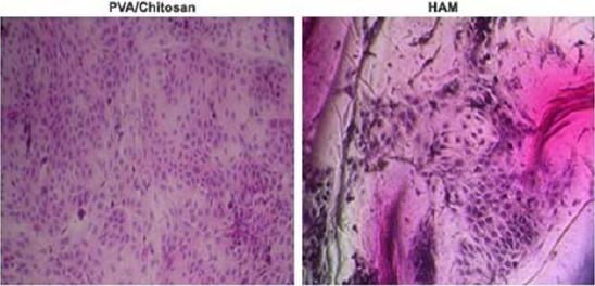 https://cdn.ncbi.nlm.nih.gov/pmc/blobs/e1e0/6182522/ecfce971de38/OAMJMS-6-1561-g004.jpg