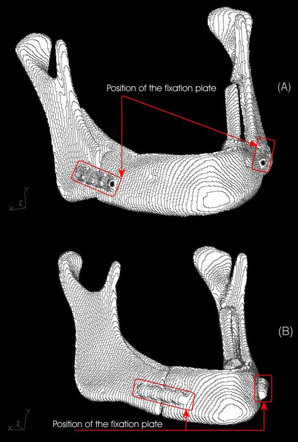 https://cdn.ncbi.nlm.nih.gov/pmc/blobs/e1e5/2174450/300bd65c06f6/1746-160X-3-38-2.jpg