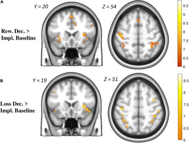 https://cdn.ncbi.nlm.nih.gov/pmc/blobs/e1e8/9365957/7a68d6ae651e/fnsys-16-867202-g003.jpg