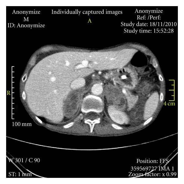 https://cdn.ncbi.nlm.nih.gov/pmc/blobs/e1f3/3350132/ef998ea3b3c8/CRIM.ONCMED2011-326815.002.jpg