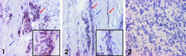 https://cdn.ncbi.nlm.nih.gov/pmc/blobs/e1f5/1852112/257088539826/1471-2407-7-55-6.jpg