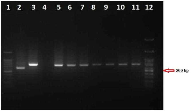 https://cdn.ncbi.nlm.nih.gov/pmc/blobs/e1f7/10936802/d69d72e48ac9/pone.0296777.g001.jpg