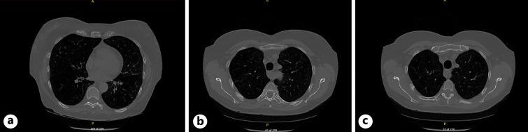 https://cdn.ncbi.nlm.nih.gov/pmc/blobs/e204/10114023/f7b8759dc165/cro-2023-0016-0001-528613_F02.jpg