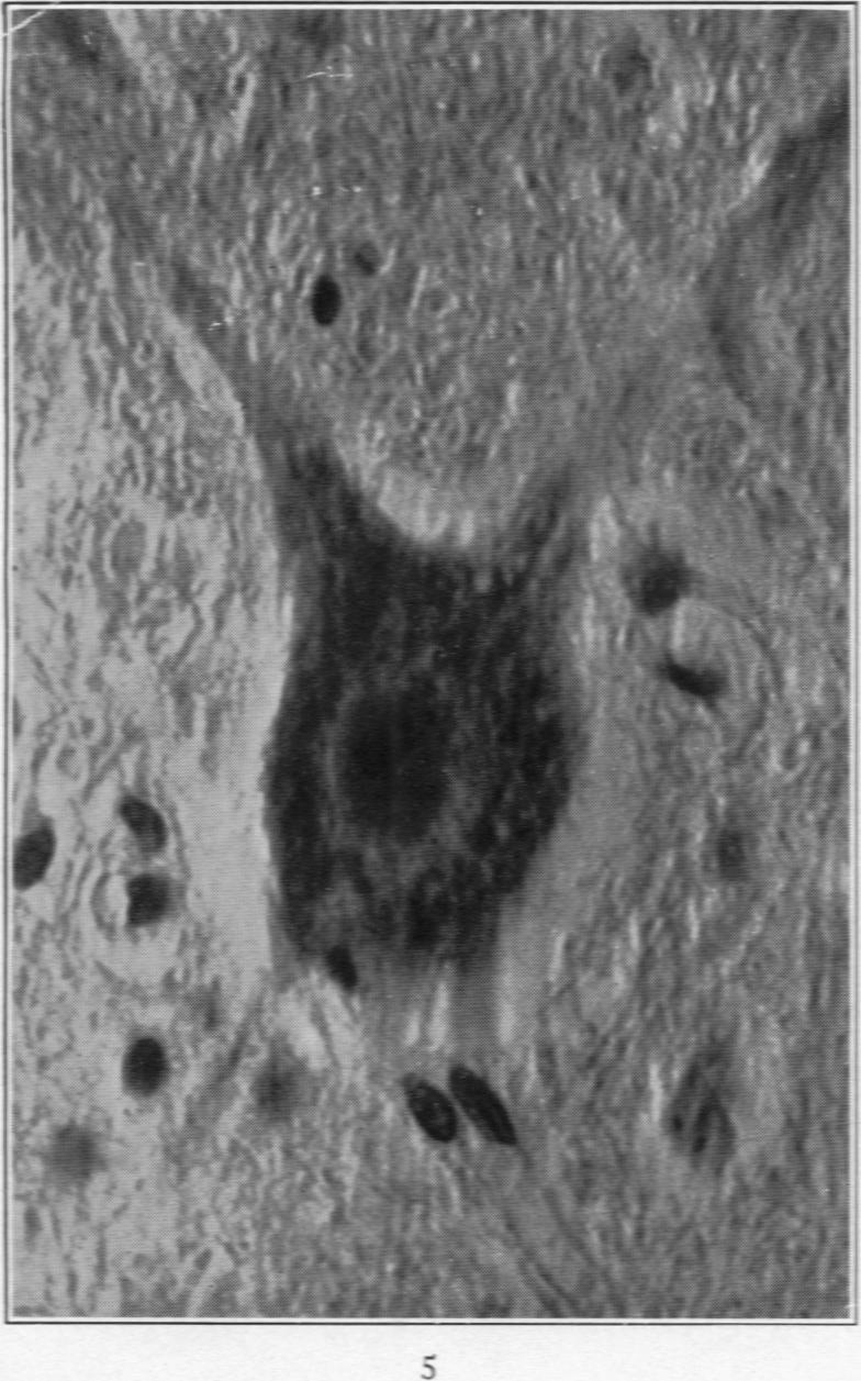 https://cdn.ncbi.nlm.nih.gov/pmc/blobs/e206/2062682/bf22090f80c4/amjpathol00722-0063-a.jpg