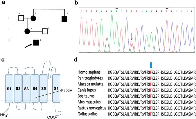 https://cdn.ncbi.nlm.nih.gov/pmc/blobs/e20b/5496848/98a0244451f2/41598_2017_3041_Fig1_HTML.jpg