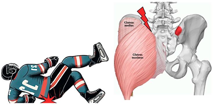 https://cdn.ncbi.nlm.nih.gov/pmc/blobs/e20f/12195931/377ae5cfebe8/muscles-04-00012-g001.jpg