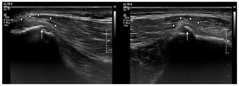 https://cdn.ncbi.nlm.nih.gov/pmc/blobs/e20f/12195931/49673ed42270/muscles-04-00012-g006.jpg