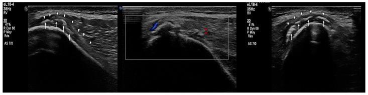 https://cdn.ncbi.nlm.nih.gov/pmc/blobs/e20f/12195931/5f930b1e3f20/muscles-04-00012-g005.jpg