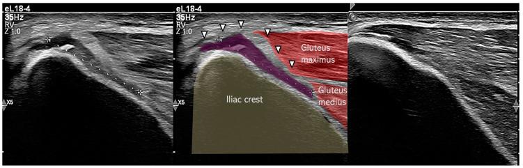 https://cdn.ncbi.nlm.nih.gov/pmc/blobs/e20f/12195931/8ab8ef481ee3/muscles-04-00012-g004.jpg