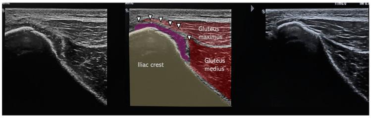 https://cdn.ncbi.nlm.nih.gov/pmc/blobs/e20f/12195931/fab05f531131/muscles-04-00012-g003.jpg