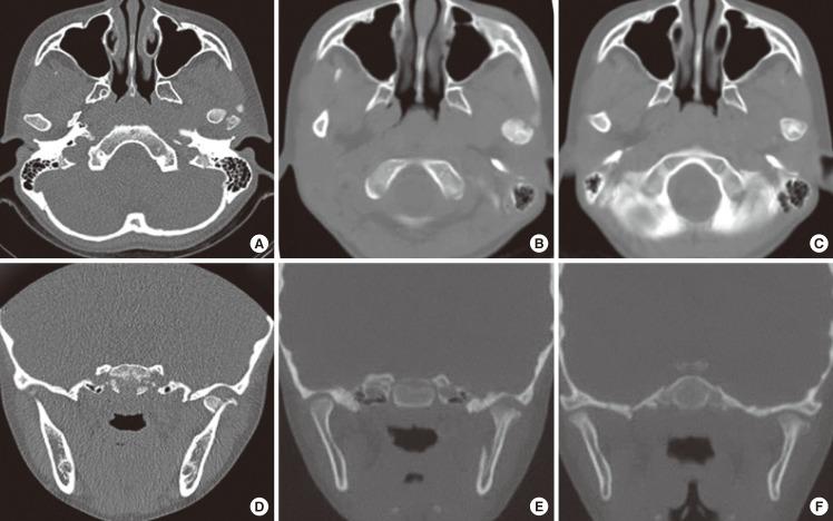 https://cdn.ncbi.nlm.nih.gov/pmc/blobs/e210/3408273/c5821917e035/aps-39-301-g002.jpg