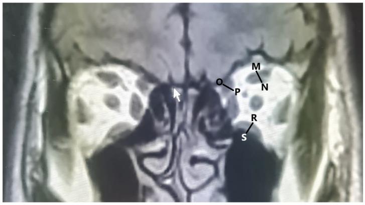 https://cdn.ncbi.nlm.nih.gov/pmc/blobs/e21f/11598162/d5544cbf9f53/tomography-10-00125-g002.jpg